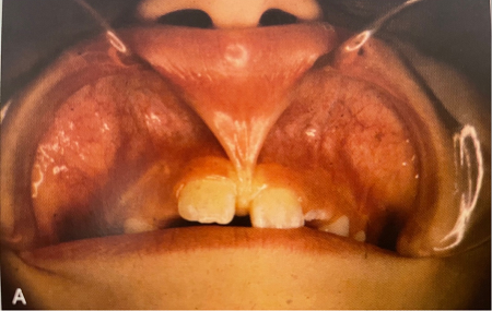 ͼƬ1