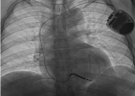 ΢�Ž�ͼ_20230526161015